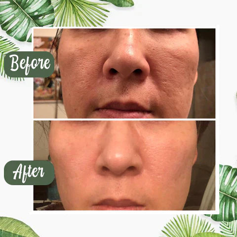 1 + 1 FREE - GreenCleanse Stick – Effortlessly Purify Your Skin & Reveal Your Natural Radiance