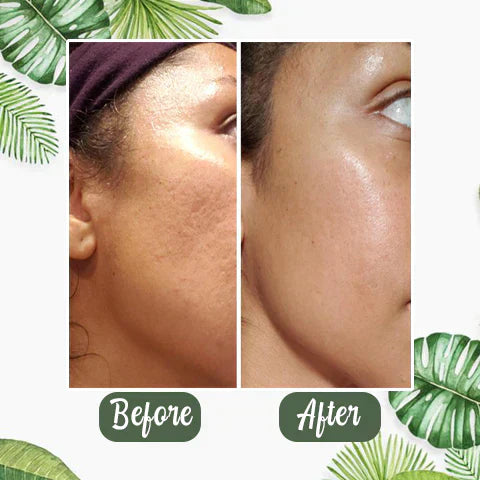 1 + 1 FREE - GreenCleanse Stick – Effortlessly Purify Your Skin & Reveal Your Natural Radiance