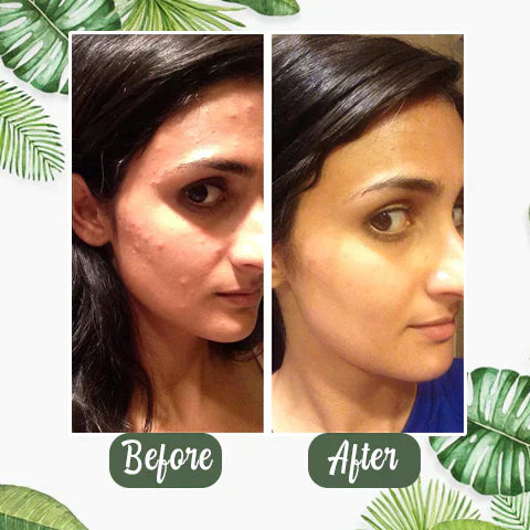 1 + 1 FREE - GreenCleanse Stick – Effortlessly Purify Your Skin & Reveal Your Natural Radiance