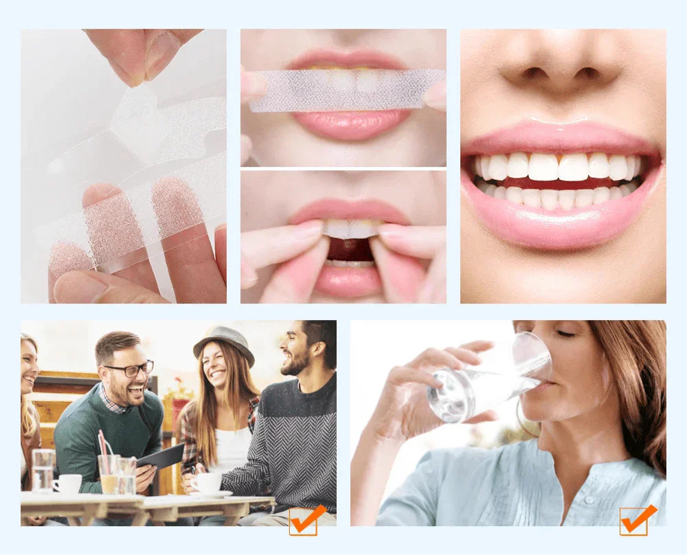 9D WhiteSmile Strips – Unlock Your Radiant Smile - 1+1 FREE