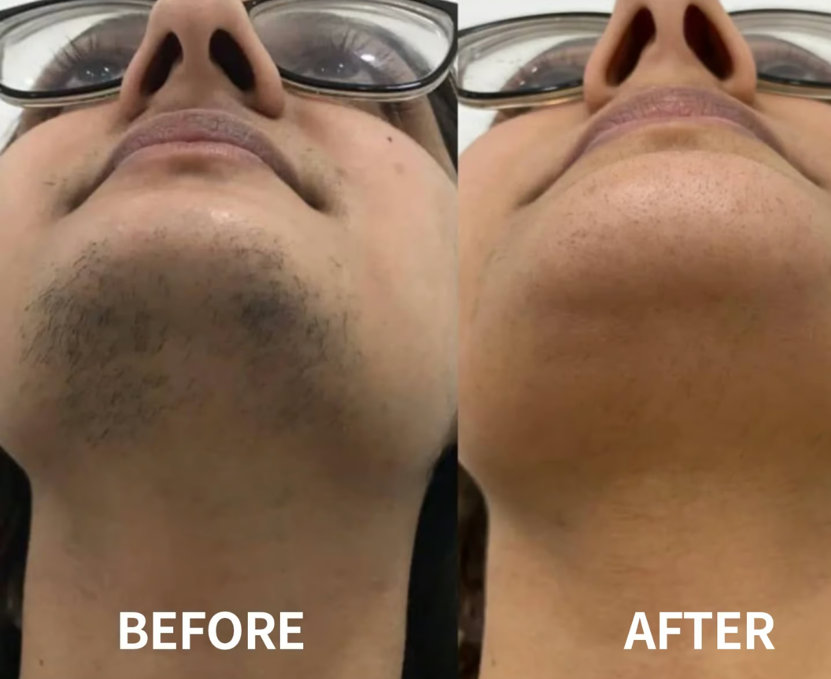 DermaSmooth Radiance- Reveal Your Flawlessly Smooth, Confident Glow 1 + 1 FREE