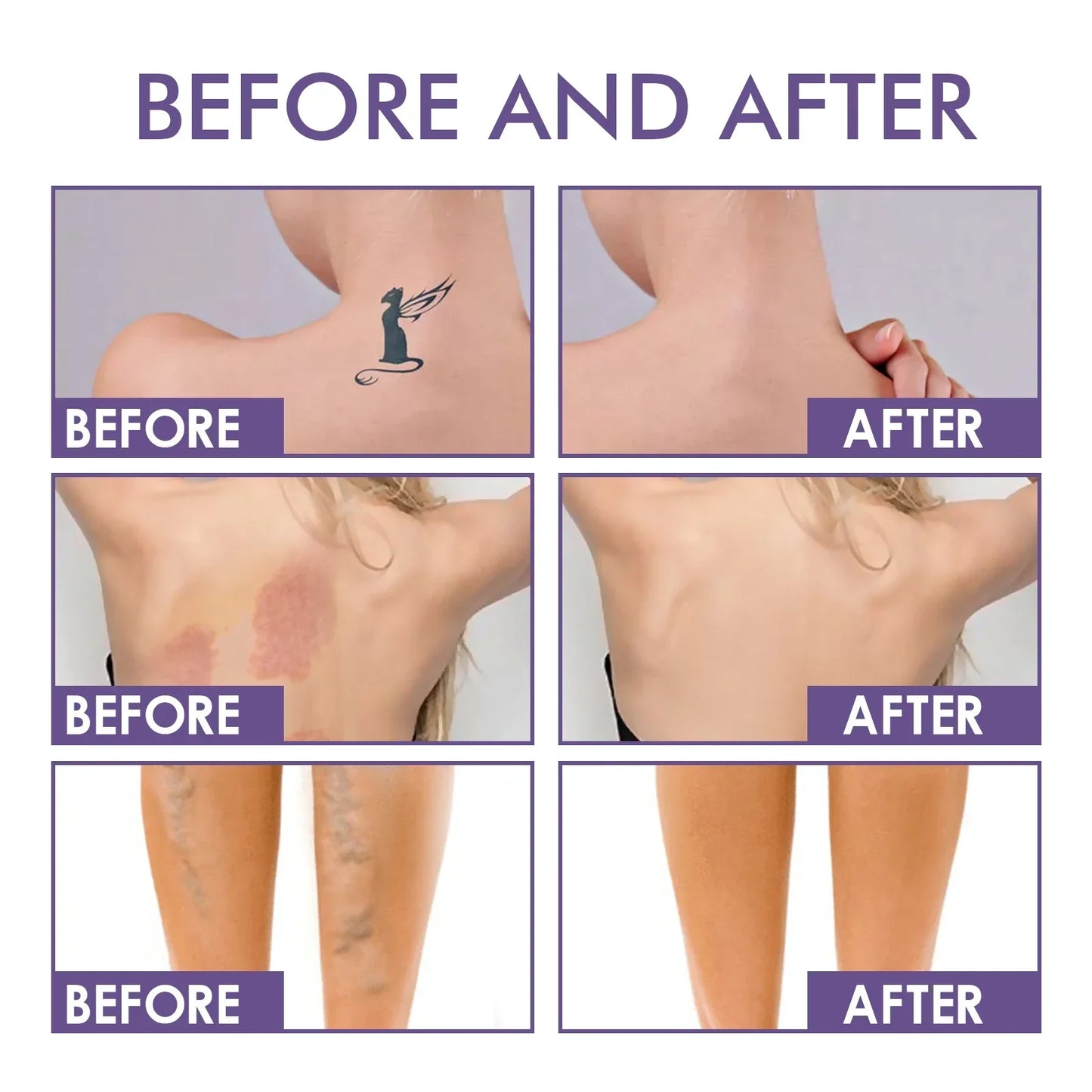 DermaVeil Body Perfector - Flawless Legs, Instantly - 50% OFF