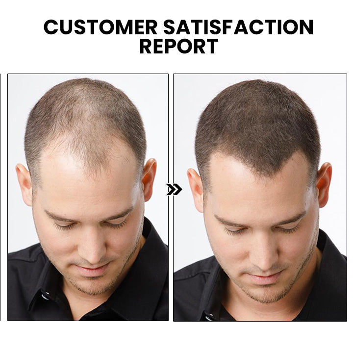 HairRevive – Unlock Your Hair’s Full Potential - 1+1 FREE