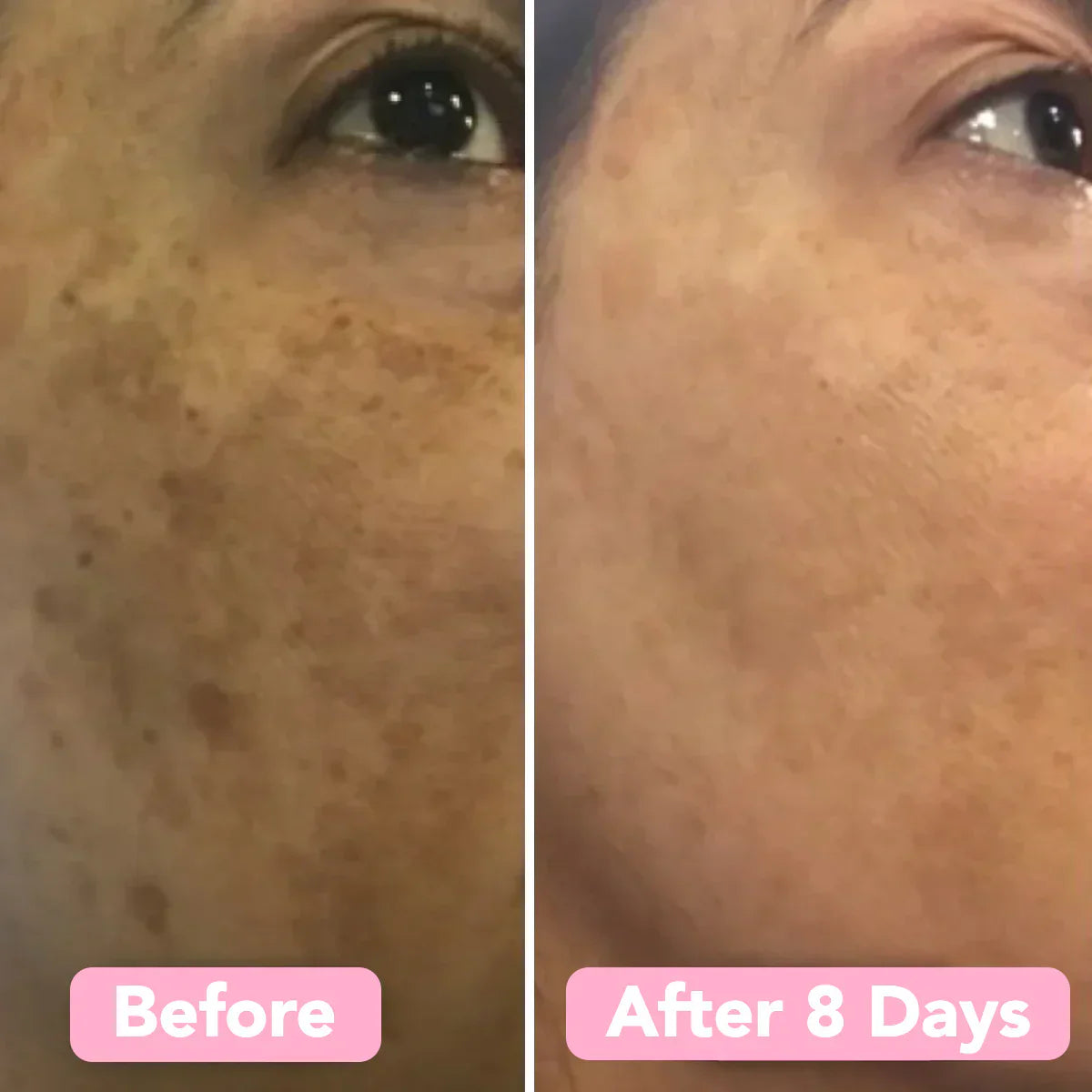 The Turmeric & Kojic Acid Glow Pads - Fade Dark Spots, Effortlessly + 50% OFF