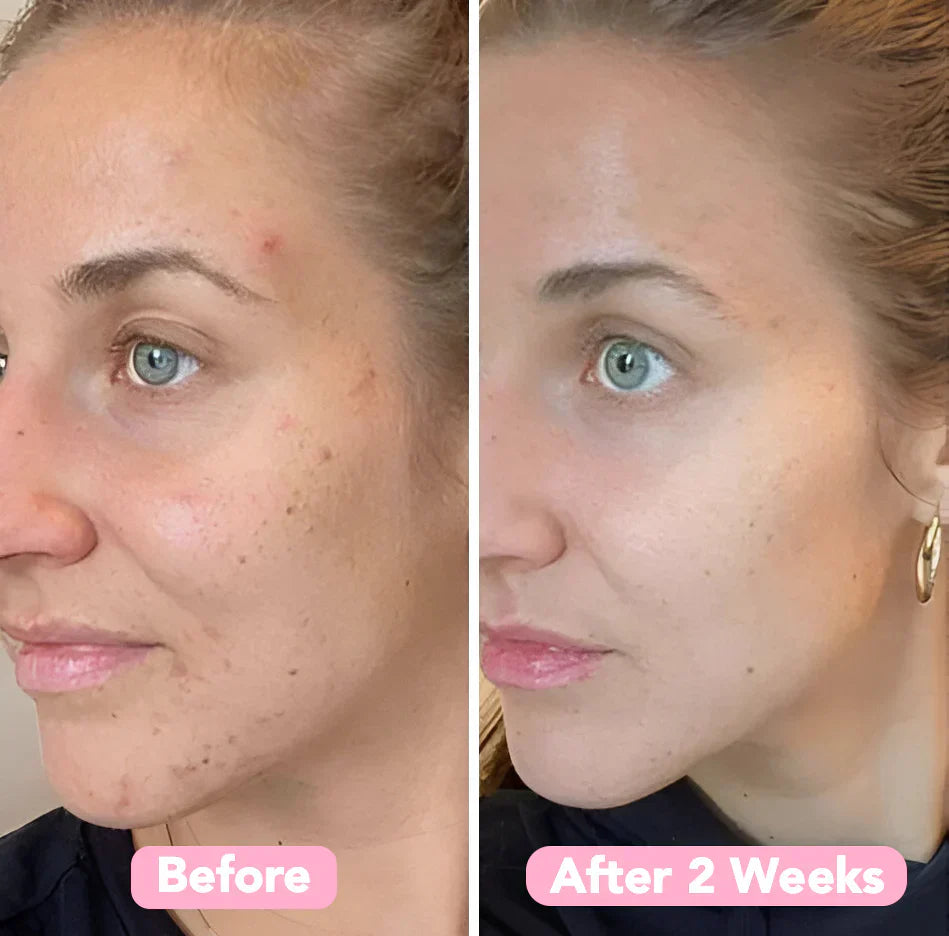 The Turmeric & Kojic Acid Glow Pads - Fade Dark Spots, Effortlessly + 50% OFF
