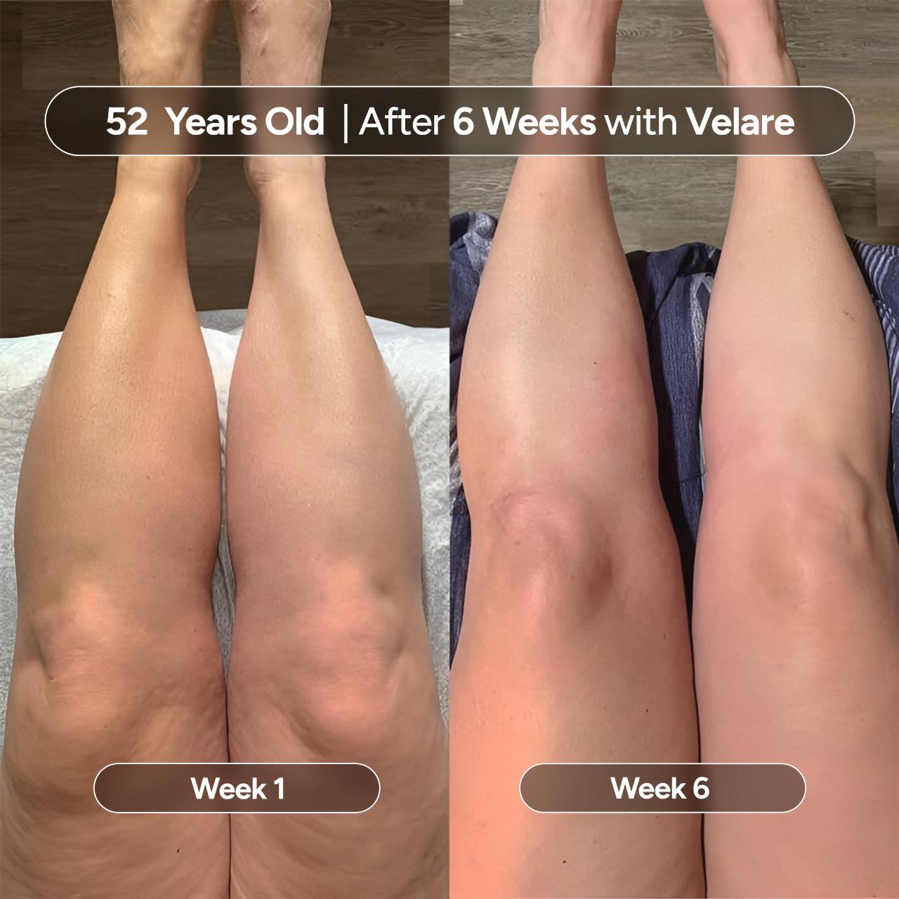 Velare Oil - Rebuild Smooth, Firm Skin - 50% OFF TODAY