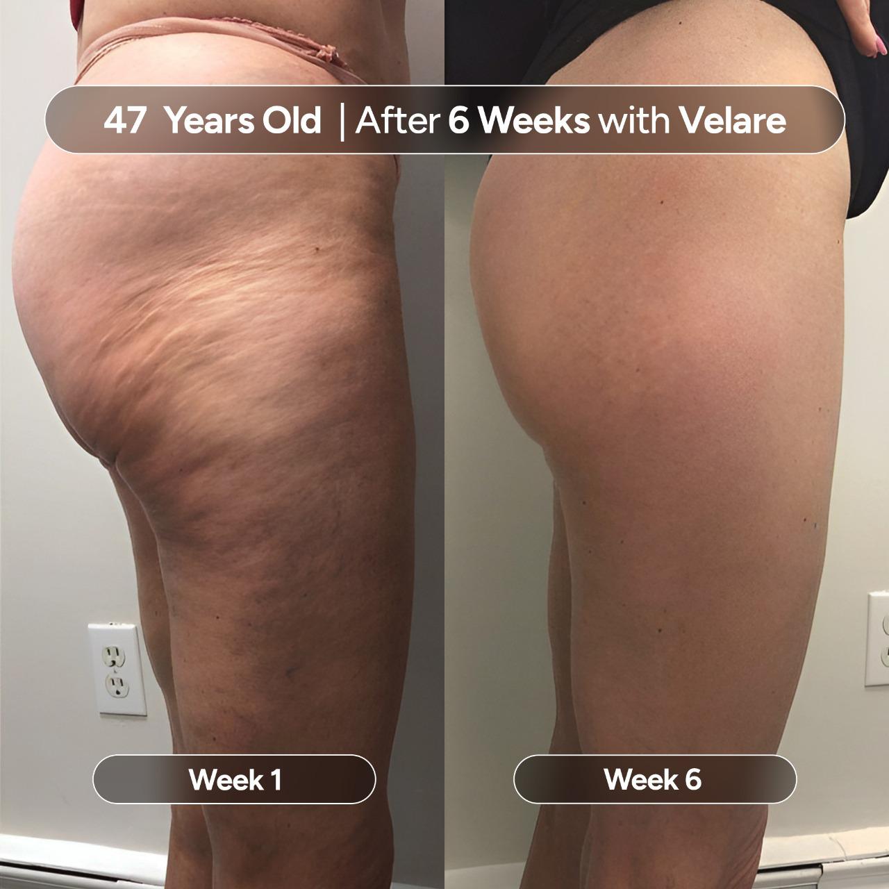 Velare Oil - Rebuild Smooth, Firm Skin - 50% OFF TODAY