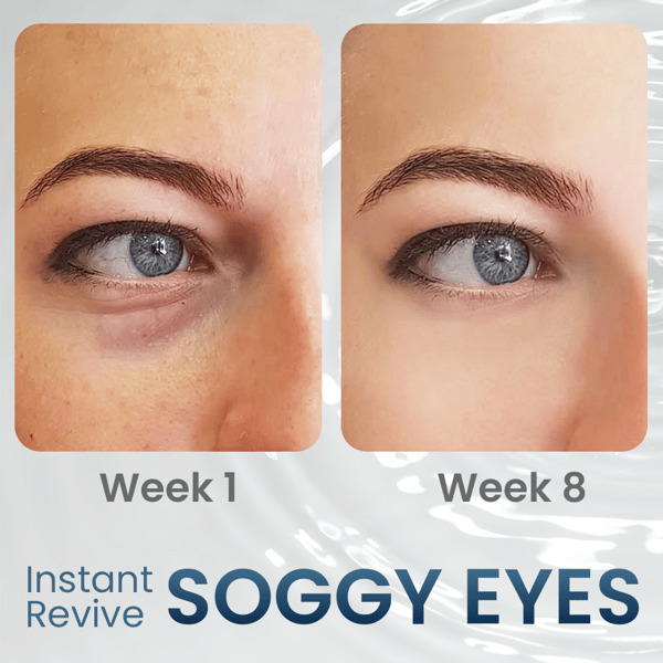 RadiantEyes Firming Eye Gel – Achieve Brighter, Firmer, Youthful-Looking Eyes - 1+1 FREE