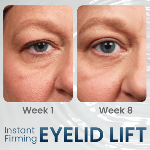 RadiantEyes Firming Eye Gel – Achieve Brighter, Firmer, Youthful-Looking Eyes - 1+1 FREE