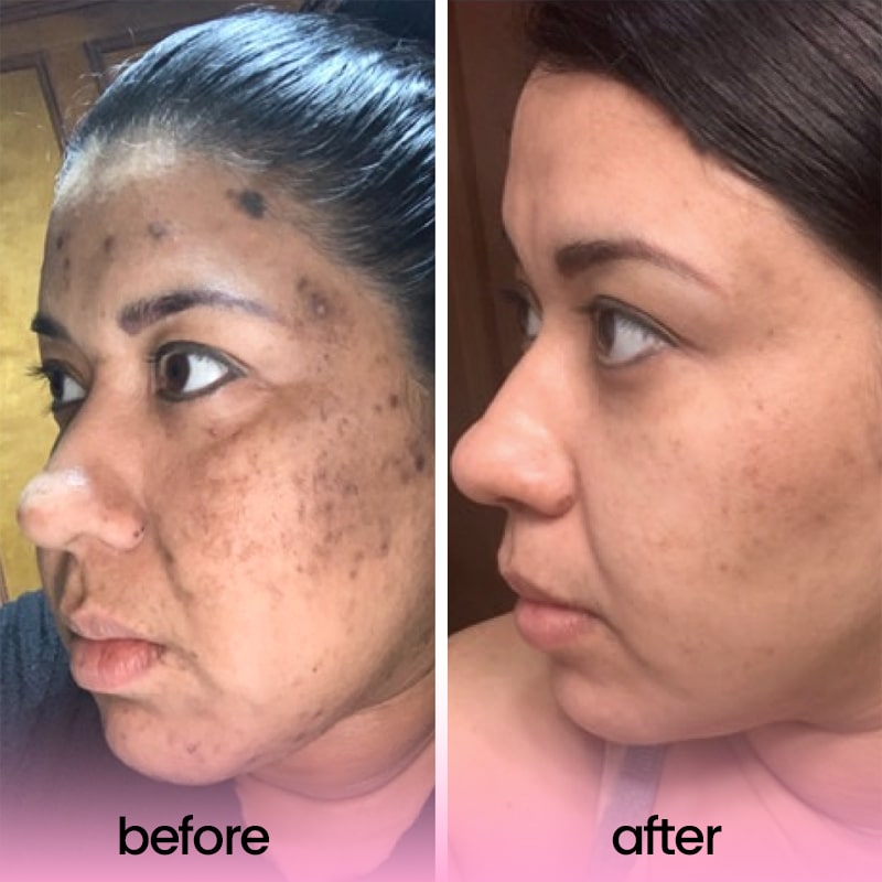 Clarity Glow Pads – Unveil Brighter, Even, Clear Skin - 50% OFF