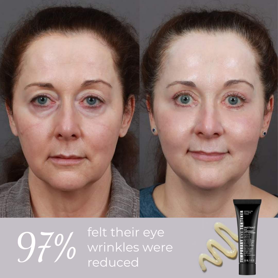 Ageless Aura Instant Lift + Erase Years in Seconds, Reveal a Timeless, Vibrant Gaze - 50% OFF