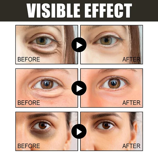 The EyeAwake Cream - The End of Tired-Looking Eyes - 50% OFF