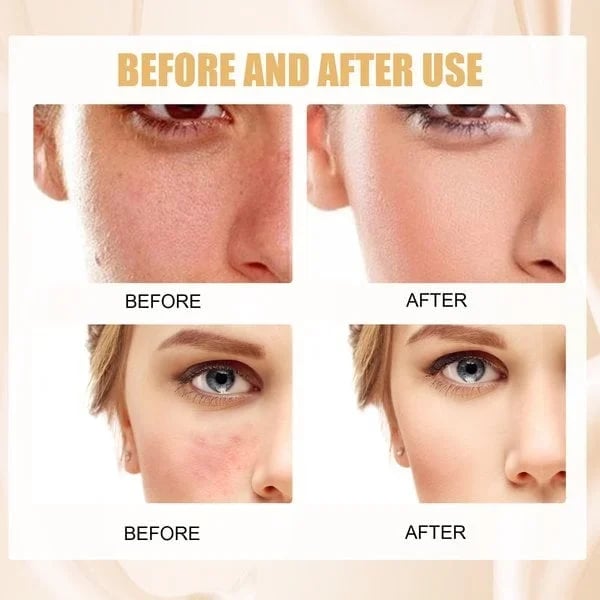 The DermaMatch Foundation - Your Perfect Shade, Guaranteed - 1+1 FREE