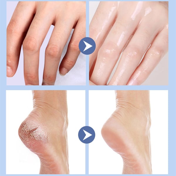 RejuvaSole Balm + Instantly Transform Dry, Cracked Feet into Soft, Supple Perfection - 50% OFF