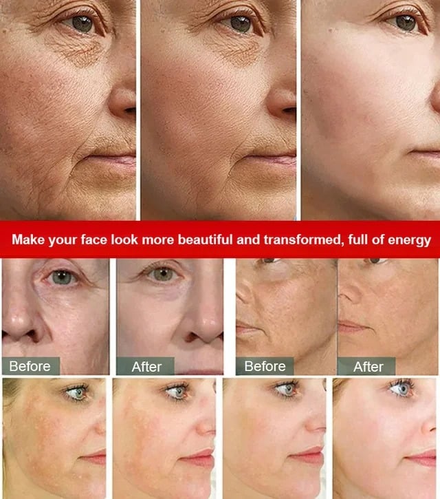 ChronoLift Serum - Visibly Lift & Firm Skin - 50% OFF