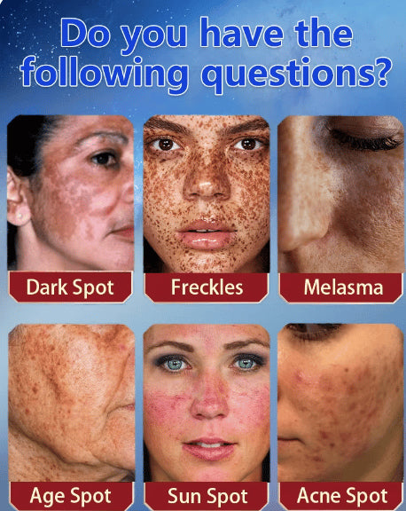 The Bikenda Beauty Cream - Fade Spots & Wrinkles, Fast + 50% OFF