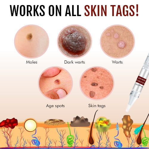 1 + 1 Free - WipeOff™ Marker & Mole Remover