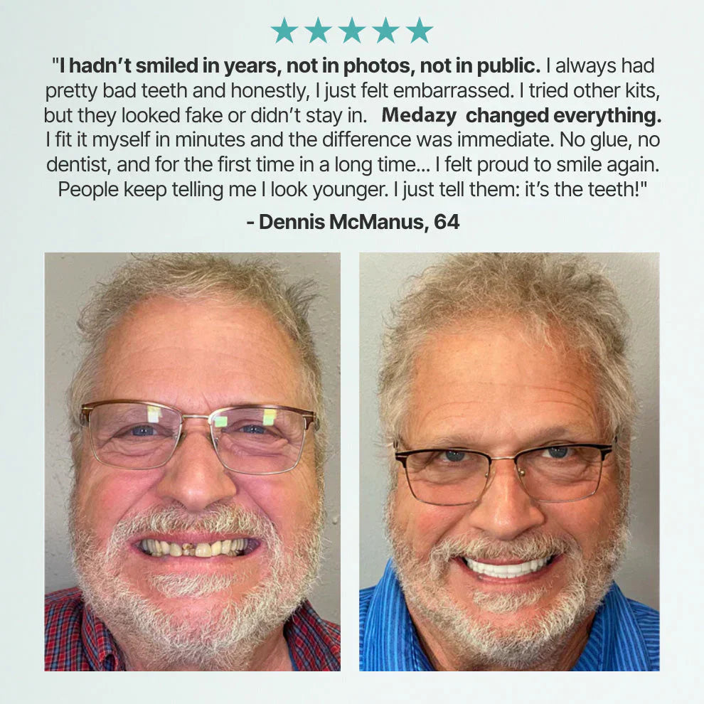 FormaSmile Dentures - Reclaim Your Confident Smile - 50% OFF
