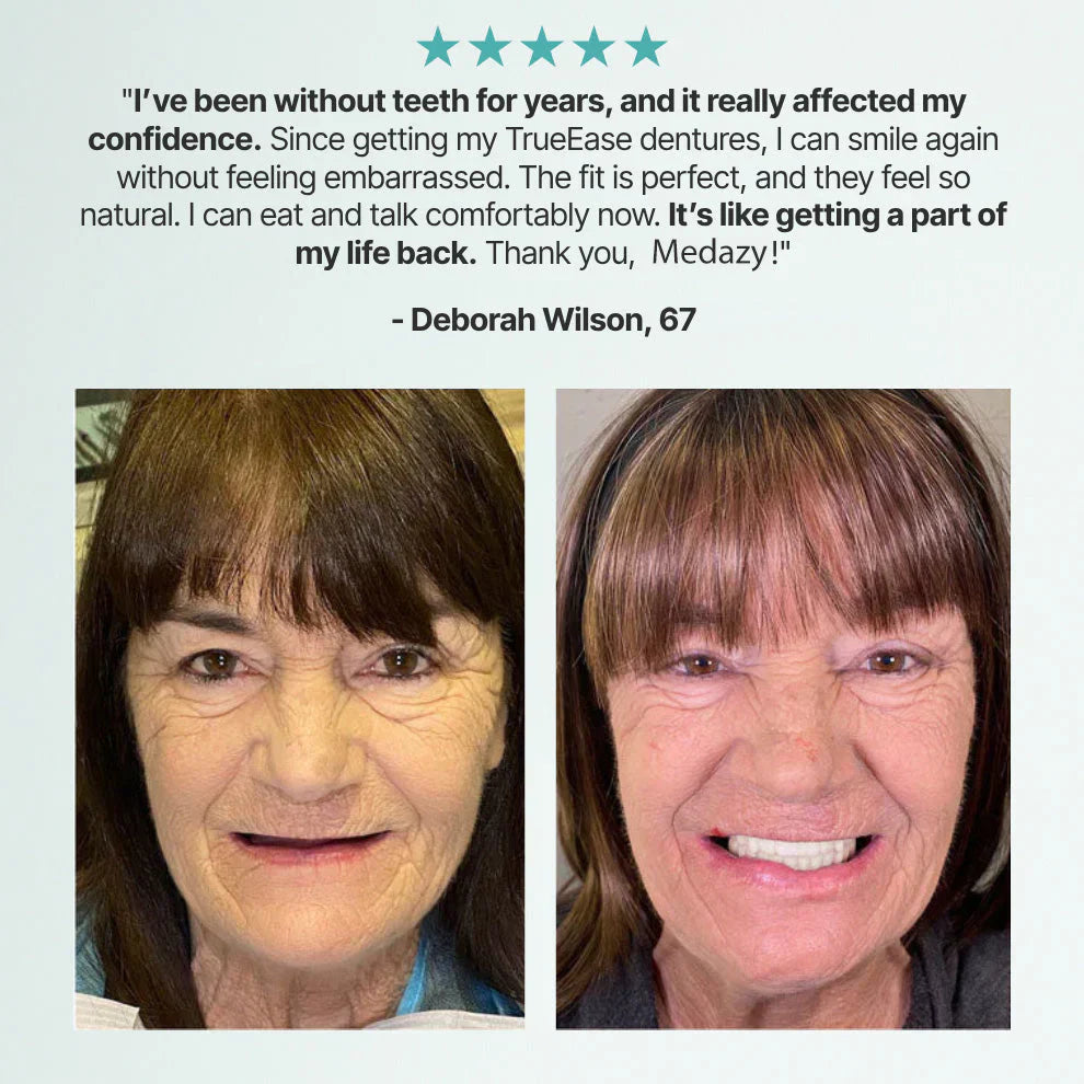 FormaSmile Dentures - Reclaim Your Confident Smile - 50% OFF