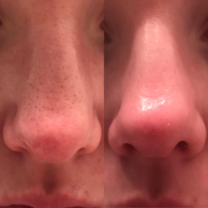 ChronoGlow Serum - Your "Glass Skin" in a Bottle - 50% OFF