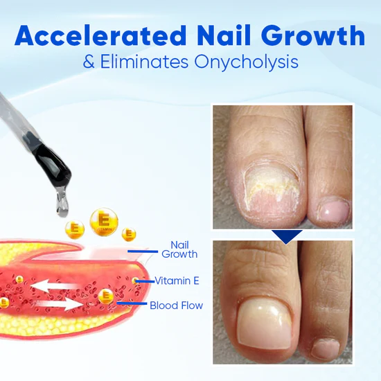OnyxoGuard Serum - Stronger Nails in 2 Weeks + 50% OFF