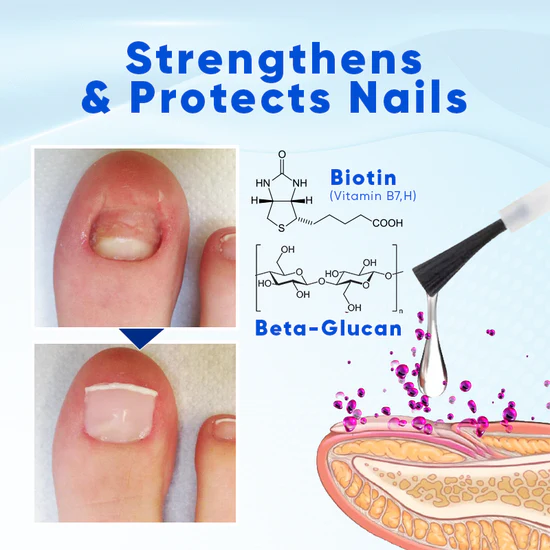 OnyxoGuard Serum - Stronger Nails in 2 Weeks + 50% OFF