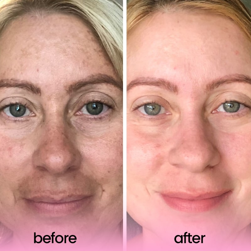Clarity Glow Pads – Unveil Brighter, Even, Clear Skin - 50% OFF
