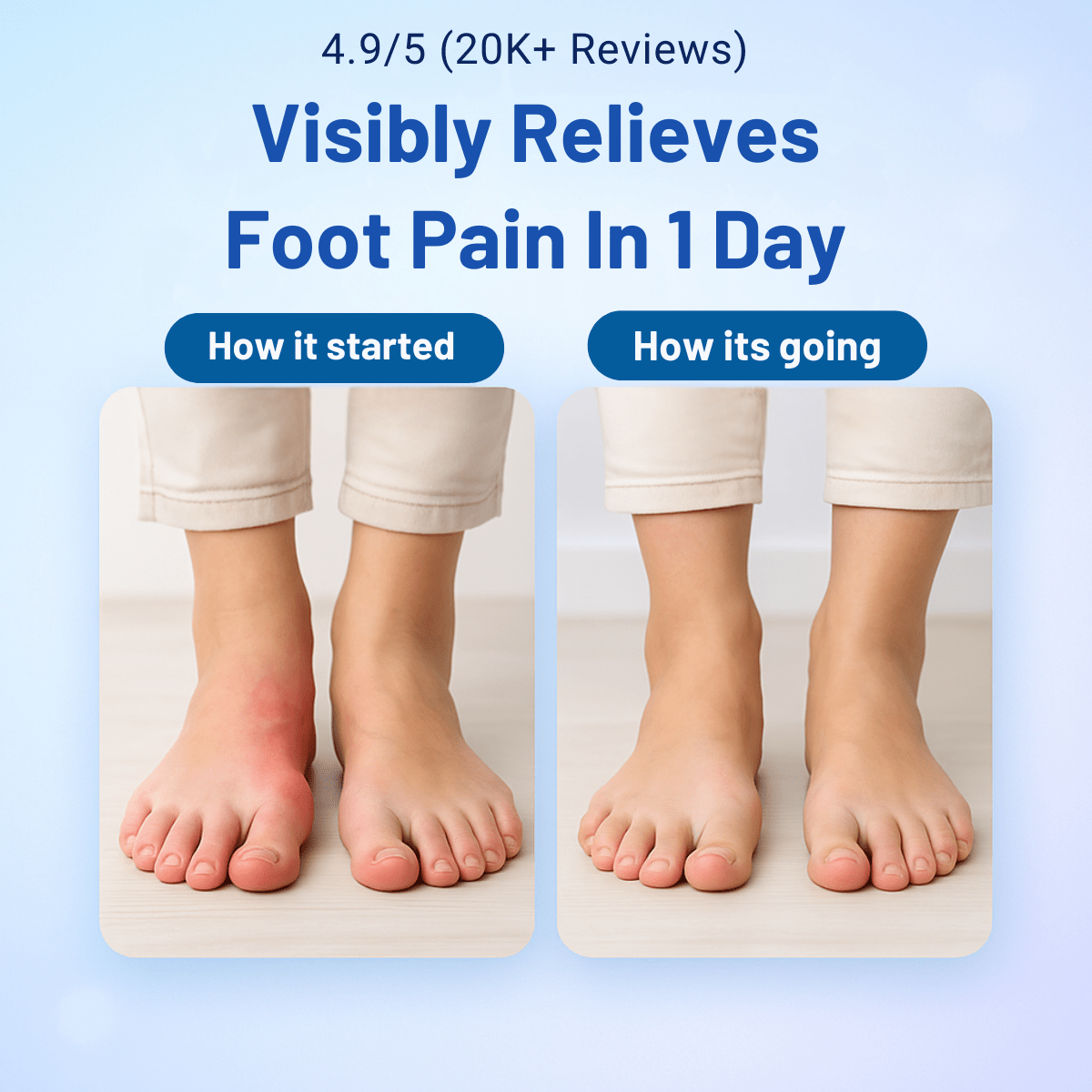 NeuroSoothe Insole - End Neuropathy Foot Pain - 50% OFF