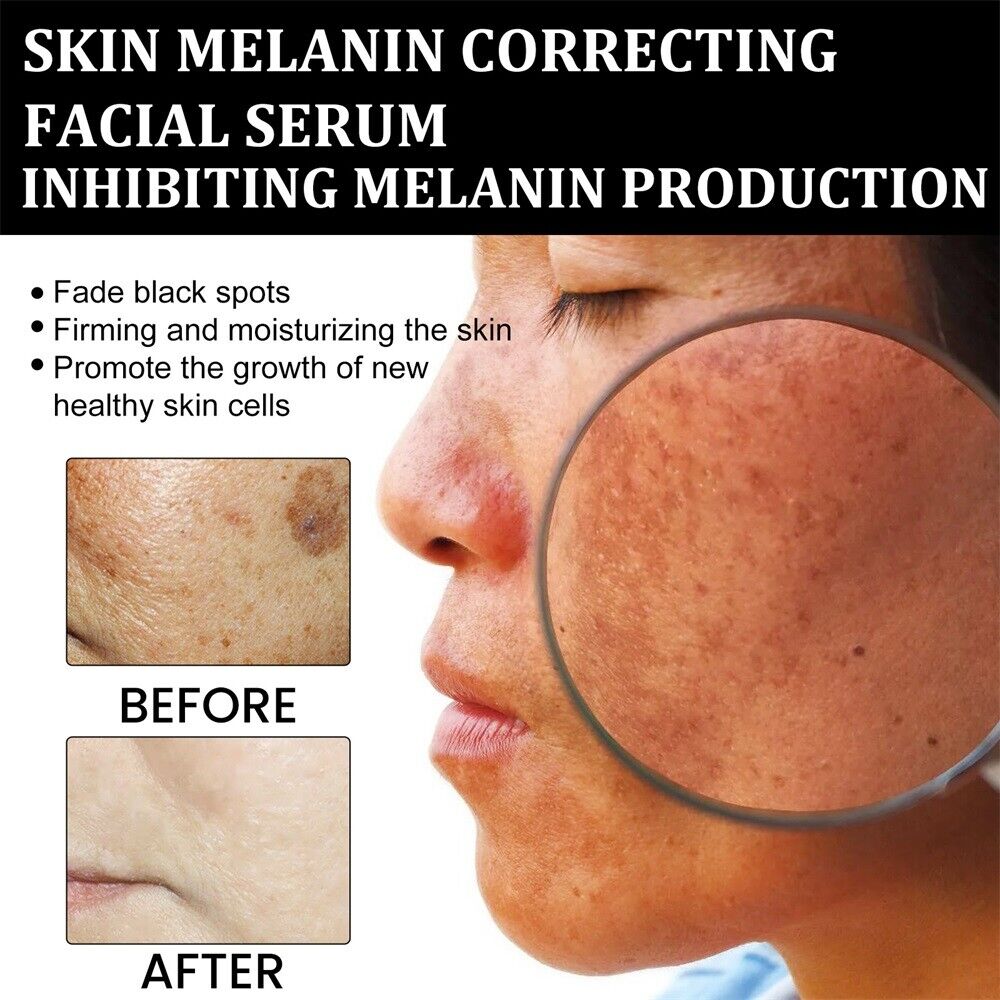 LuminaBright - Achieve a radiant, luminous complexion free from dark spots and uneven skin tone.