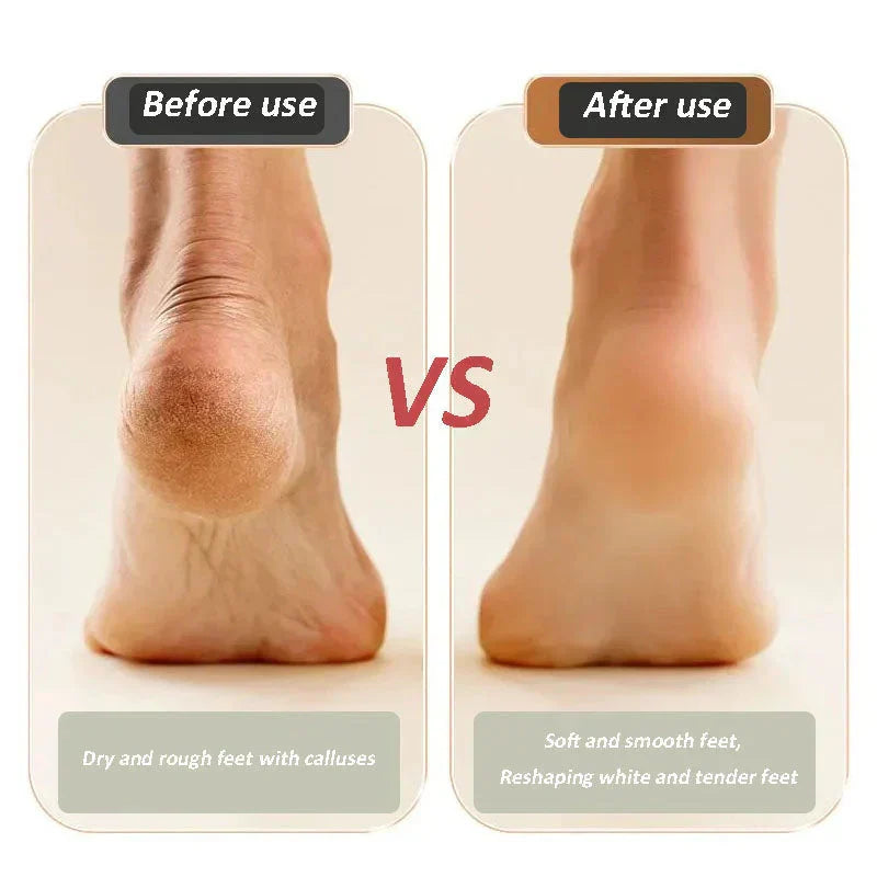 SoleSmooth Pro - Get Pedicure-Perfect Feet in Minutes - 50% OFF