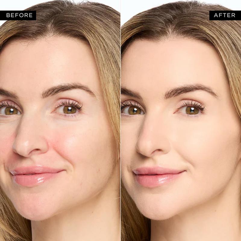 AuraCorrect Undereye Elixir + Reclaim Your Luminous, Ageless Gaze - 50% OFF
