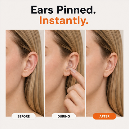 Veilo – Invisible Silicone Ear Clips, 10-Size Comfort Fit Set + 1+1 FREE