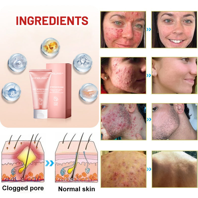 YouthRenew PM Mask – Wake Up to Radiant, Youthful Skin - 1+1 FREE