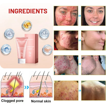 YouthRenew PM Mask – Wake Up to Radiant, Youthful Skin - 1+1 FREE