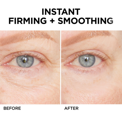 Ageless Aura Instant Lift + Erase Years in Seconds, Reveal a Timeless, Vibrant Gaze - 50% OFF