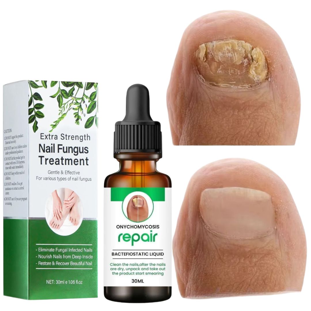 NailRevive – The Ultimate Nail Transformation Serum - 1+1 FREE