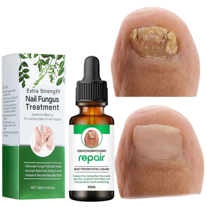 NailRevive – The Ultimate Nail Transformation Serum - 1+1 FREE