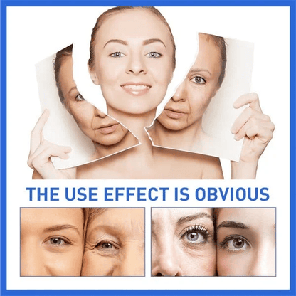 NeuroTox Serum - The Needle-Free Wrinkle Solution - 50% OFF