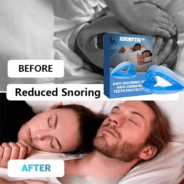 The SilentNight Protector - End Snoring & Teeth Grinding + LAST DAY SALE 50% OFF