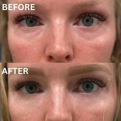 CryoGlow Patches - A Camera-Ready Look in 60 Minutes - 50% OFF