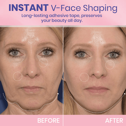 1 + 1 FREE - Instant V-Lift Tape – Lift Years Off Instantly!