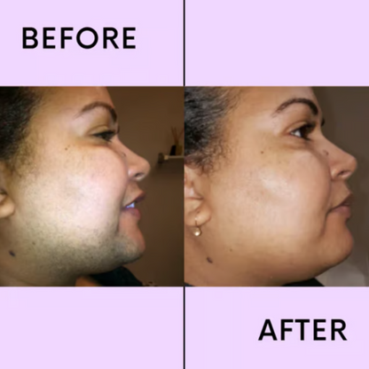 SmoothEase Facial Hair Remover - Smooth Skin, No Pain - 1+1 FREE