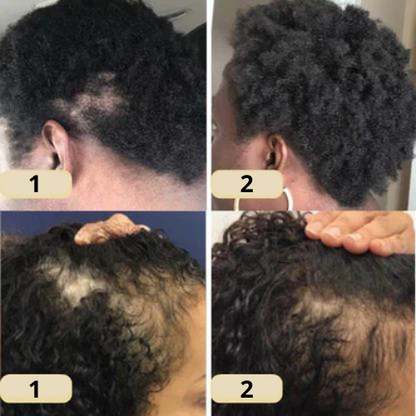 The EELHOE Natural Growth Oil - Rosemary, Castor, and Green Coffee for Thicker, Fuller Hair +  50% OFF