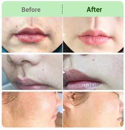 DermaSmooth - Silky-Smooth Skin, Zero Irritation - 50% OFF