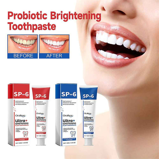The Probiotic Whitening Toothpaste - A Healthier Mouth, A Whiter Smile + 50% OFF