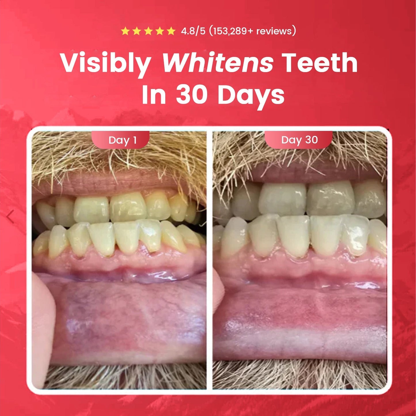 Lumiva™ – Probiotic Whitening Toothpaste with 10% Nano-Hydroxyapatite & 8 Live Strains + 50% OFF
