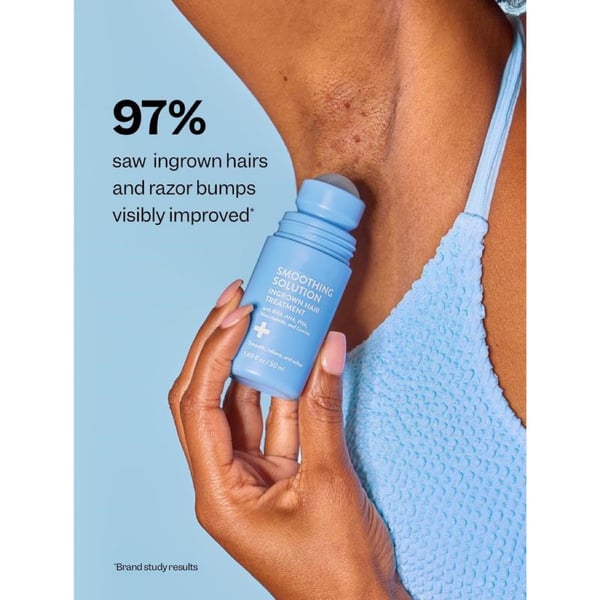 DermaCalm - The End of Ingrown Hairs & Razor Bumps - 50% OFF