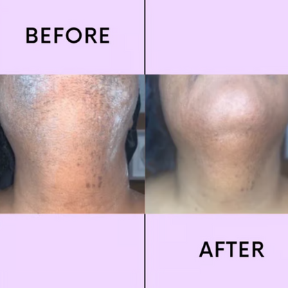 SmoothEase Facial Hair Remover - Smooth Skin, No Pain - 1+1 FREE