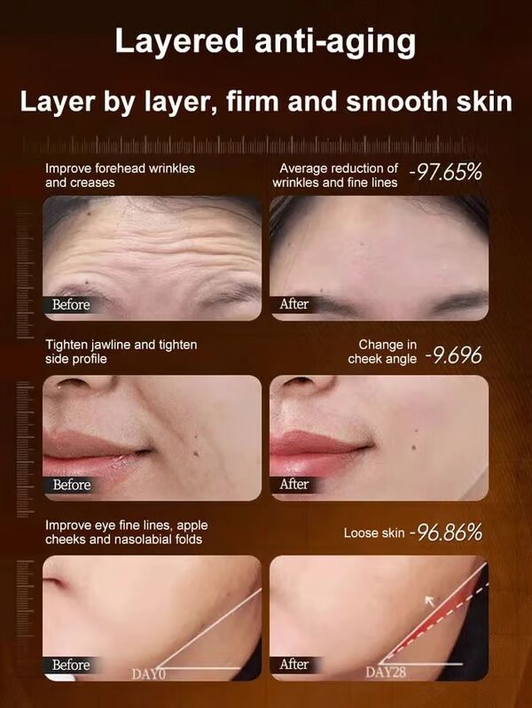 The RevitaLift Collagen Essence - One Touch to Remove Wrinkles + 50% OFF