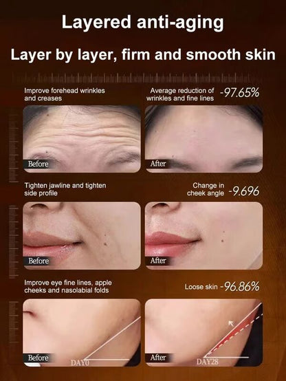 The RevitaLift Collagen Essence - One Touch to Remove Wrinkles + 50% OFF